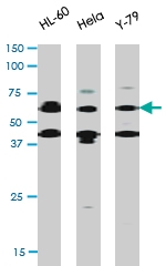 PAB0581 - RAD9A