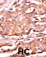 PAB0581 - RAD9A