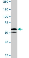 PAB0582 - RAD9A