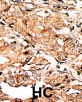 PAB0582 - RAD9A