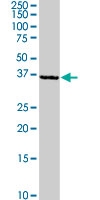 PAB0583 - RAD9A
