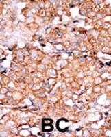 PAB0583 - RAD9A