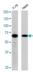 PAB0588 - RAD9A