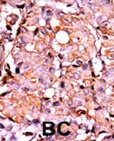 PAB0588 - RAD9A