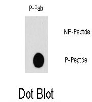 PAB0590 - RAF1