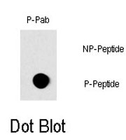 PAB0591 - RAF1