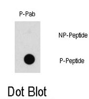 PAB0592 - RAF1