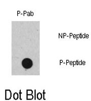 PAB0593 - RAF1