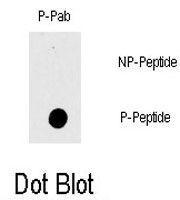 PAB0594 - RAF1