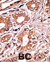 PAB0595 - Retinoblastoma-associated protein / RB1
