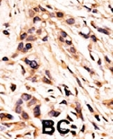 PAB0596 - Retinoblastoma-associated protein / RB1