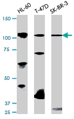 PAB0597 - Retinoblastoma-associated protein / RB1