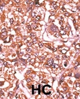 PAB0597 - Retinoblastoma-associated protein / RB1