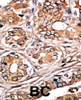 PAB0598 - Retinoblastoma-associated protein / RB1