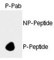 PAB0599 - Retinoblastoma-associated protein / RB1