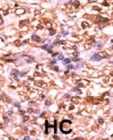 PAB0599 - Retinoblastoma-associated protein / RB1