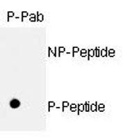 PAB0602 - Retinoblastoma-associated protein / RB1