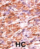 PAB0602 - Retinoblastoma-associated protein / RB1