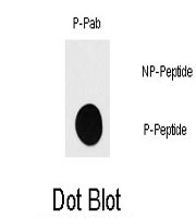 PAB0606 - RPS6KB1 / STK14A
