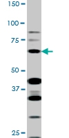 PAB0610 - SMAD3