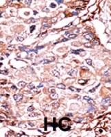 PAB0610 - SMAD3