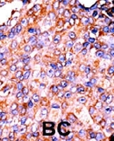 PAB0615 - STAT3
