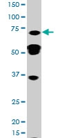 PAB0616 - STAT3