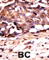 PAB0616 - STAT3