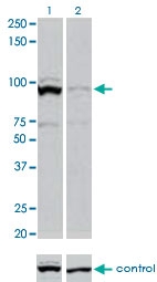 PAB0617 - STAT3