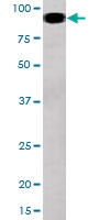 PAB0620 - STAT5 / STAT5A
