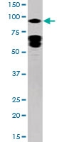 PAB0621 - STAT5 / STAT5A