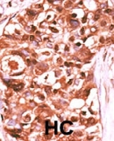 PAB0621 - STAT5 / STAT5A