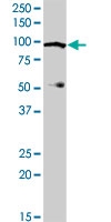 PAB0632 - WEE1 / Wee1-like protein kinase