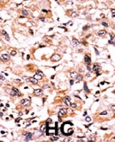 PAB0632 - WEE1 / Wee1-like protein kinase