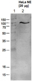 PAB0648 - EZH2 / KMT6