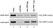 PAB0661 - RFXAP