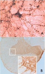 PAB0691 - Beta-Synuclein / SCNB