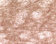 PAB0692 - Gamma-Synuclein / SNCG