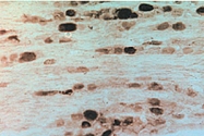 PAB0694 - GFRA2 / GDNFR-beta