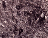 PAB0696 - Amyloid beta A4 protein / APP
