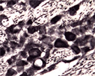 PAB0697 - ATP13A2 / PARK9