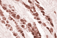 PAB0702 - HAP1