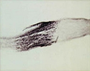 PAB0706 - Neurotrophin 3 / NTF3