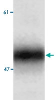 PAB0712 - APG5L / ATG5