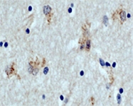 PAB0712 - APG5L / ATG5