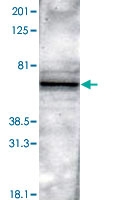 PAB0720 - PTH Receptor 2