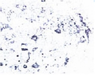 PAB0721 - TrkB