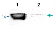 PAB0725 - Superoxide Dismutase 1 / SOD1