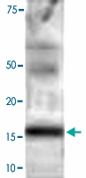 PAB0729 - GABARAPL2