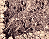 PAB0734 - Neurotensin receptor 3
